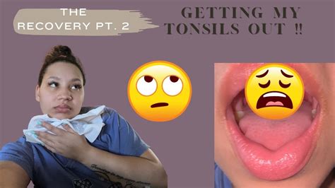 My Tonsillectomy Experience Vlog The Recovery ️‍🩹 Part 2 Youtube