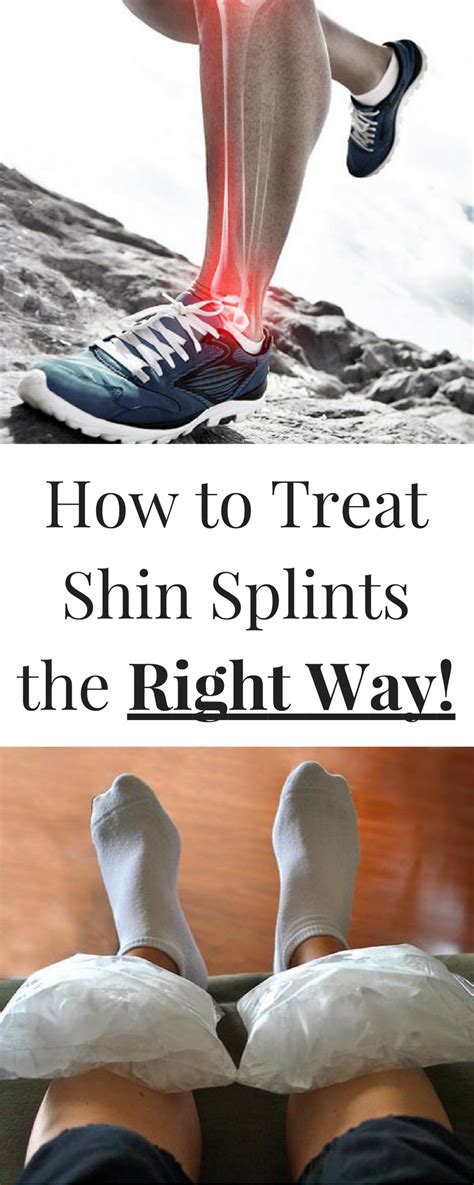 How To Treat Shin Splints The Right Way Shin Splints Shin Splints