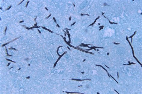 Tissue culture techniques have been used to culture many kinds of hybrid cells that contain chromosomes from different species in the same cell, allowing the functions of individual. Public Domain Picture | Under a magnification of 500X ...