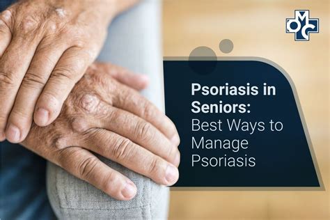 Psoriasis In Seniors Best Ways To Manage Psoriasis