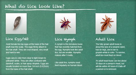 Recognize Lice Lice Removal And Treatment Ladibugs Clinic