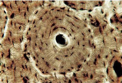 Online quiz to learn compact bone microscope slide labeled ; Last week's anatomic structure was a microscopic view of ...
