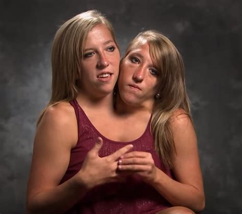 Conjoined Twins Abby And Brittany Thrilled With Their New Job