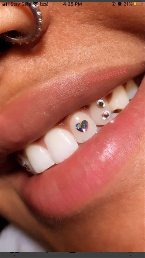 Teeth Gem Teeth Jewelry Teeth Gem Diamond Teeth
