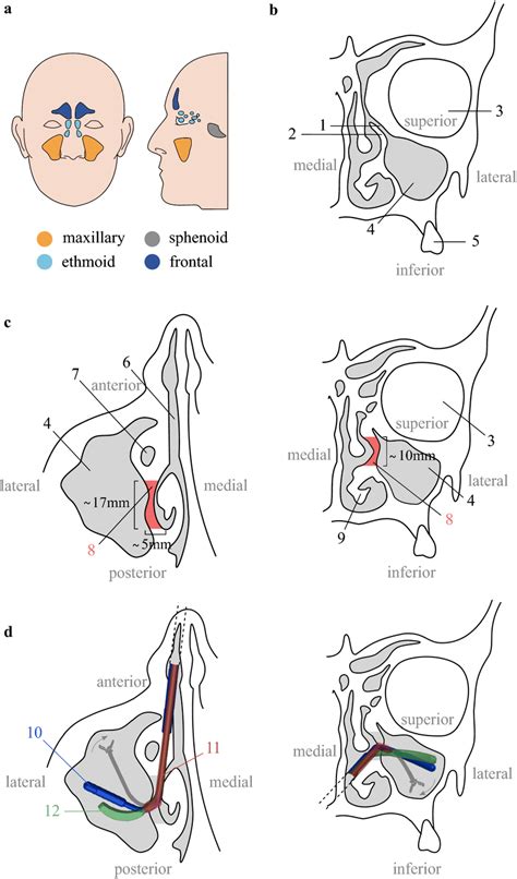 Maxillary Sinus Anatomy Alocation Of The Paranasal Sinuses Adapted