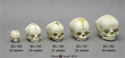 Human Fetal Skull Set Of 5 Skulls Bone Clones Inc Osteological