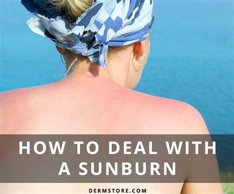 How Do You Treat And Relieve Sunburn If And When You Do Get It See Our