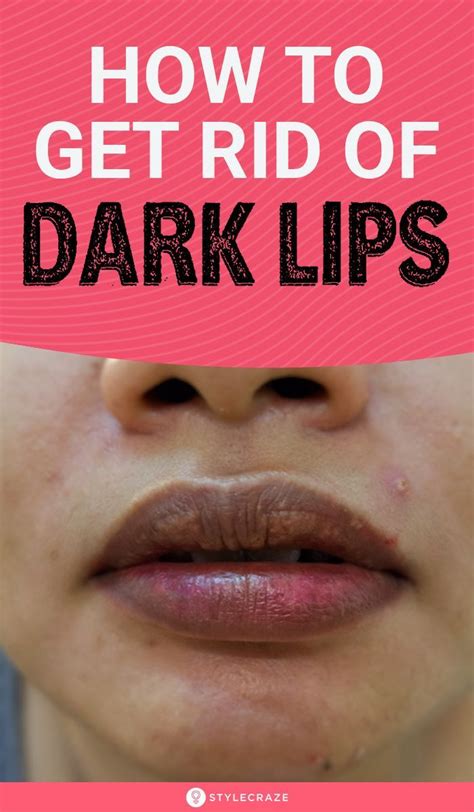 how to lighten dark lips 7 home remedies dark lips lips discoloration remedies
