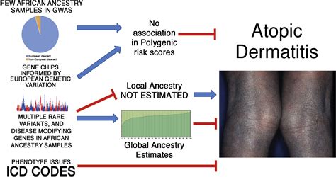 Atopic Dermatitis Race And Genetics Journal Of Allergy And Clinical