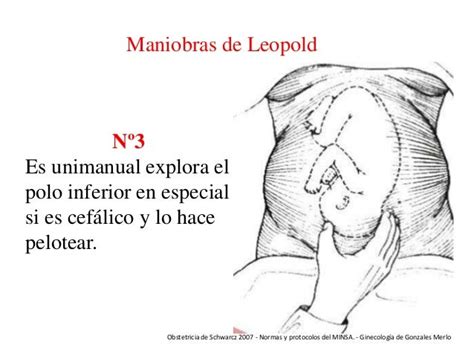 Maniobras De Leopold