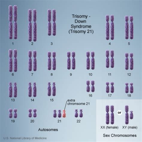 Trisomy Embryology