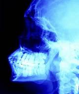 Pictures of Dental X Ray Insurance
