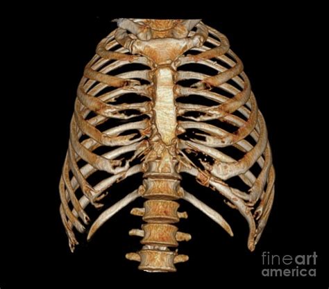 Rib Cage Photograph By Zephyrscience Photo Library Fine Art America