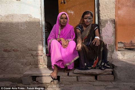 Khushboo Devi Has Acid Thrown In Face By Her Own Father Daily Mail Online