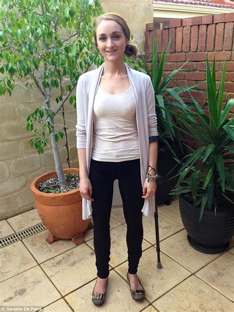 Perth Mother Who Spent 20 Years On Crutches Finally Receives Prosthetic
