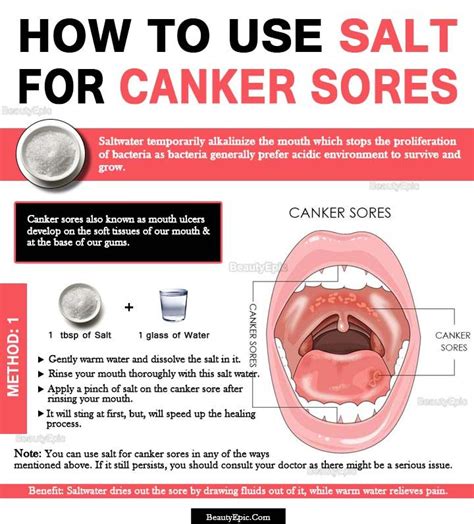 Ingredients Canker Sore Canker Sore Treatment Cankers