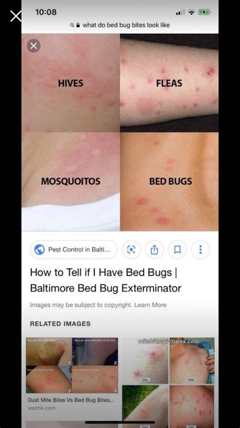 Pin By Kristen Stumpo On Kidsstuff Bed Bug Bites Pest Control Bed