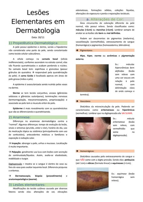 Lesões Elementares em Dermatologia Lesões Elementares em Dermatologia Data