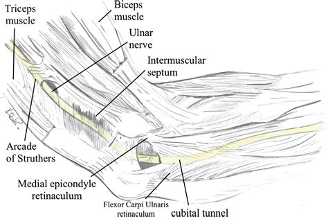 Ulnar Nerve Clinical Tree