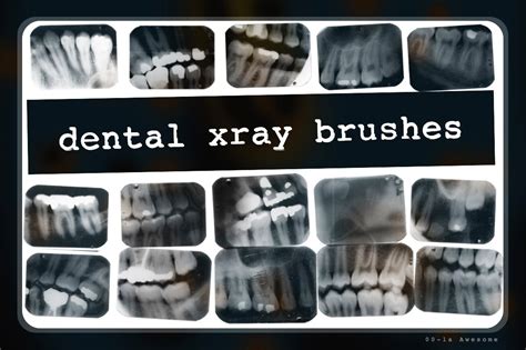 Make your portraits amazing in under a minute! Dental X-ray Brushes ~ Photoshop Add-Ons ~ Creative Market