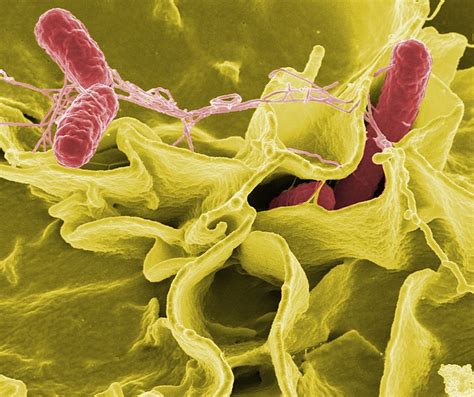 What Is The Difference Between Shigella And Salmonella Pediaacom