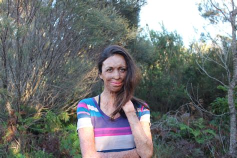 So Does It Work Turia Pitt