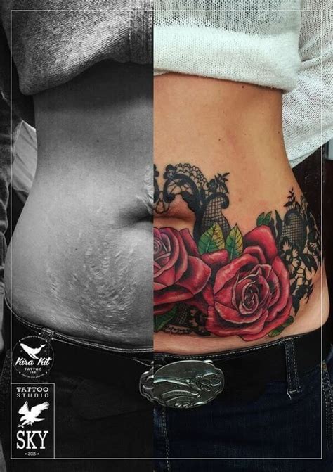 Belly Stretch Mark Cover Up Tattoos Before And After