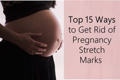 Top 15 Ways To Get Rid Of Pregnancy Stretch Marks
