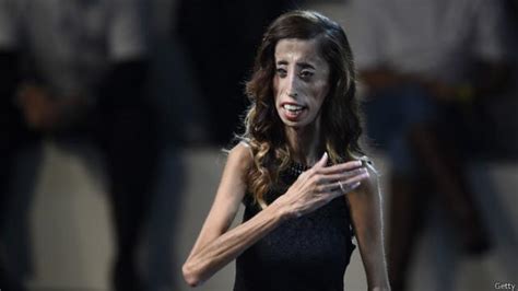 la inspiradora historia de superación de lizzie velásquez la mujer más fea del mundo bbc