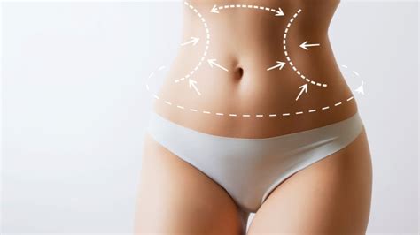 360 Liposuction Combined With Tummy Tuck A Comprehensive Guide To