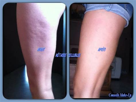 The Cellublue Cup The New Anti Cellulite And Slimming Cup