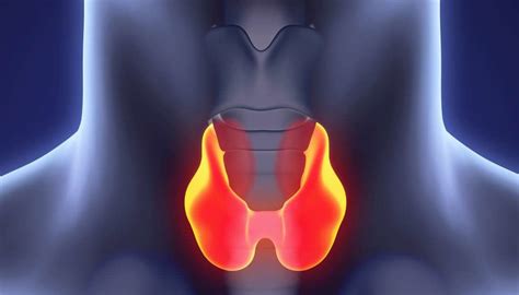 thyroid cancer types stages signs symptoms risk factors diagnostic procedures treatment