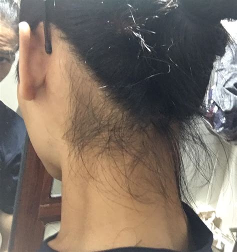 Aggregate More Than 60 Hair On Back Of Neck Super Hot Ceg Edu Vn