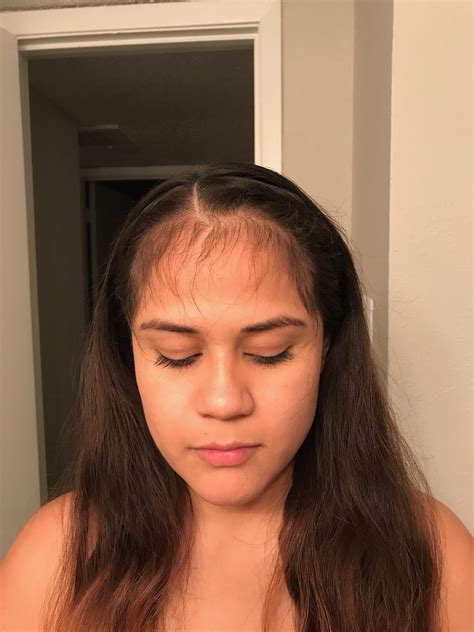 Specific Can Someone Please Remove All My Baby Hair I Want To See