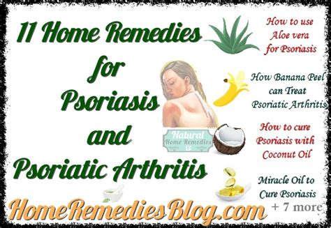 The Top 11 Home Remedies For Psoriasis And Psoriatic