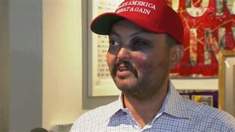 Man Claims He Was Attacked For Wearing Maga Hat Wtvc