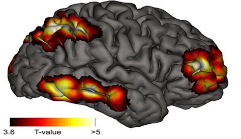 The Seat Of Meta Consciousness In The Brain Neuroscience News