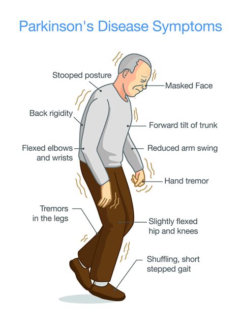 Symptoms Of Parkinsons Apda