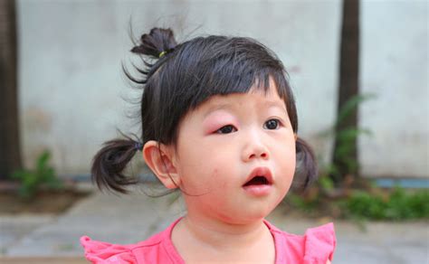 陰茎が痛い | 病気スコープ