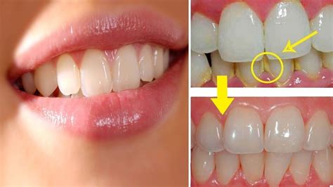 Pin on Dicas de Saude