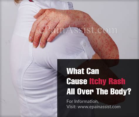 What Can Cause Itchy Rash All Over The Body