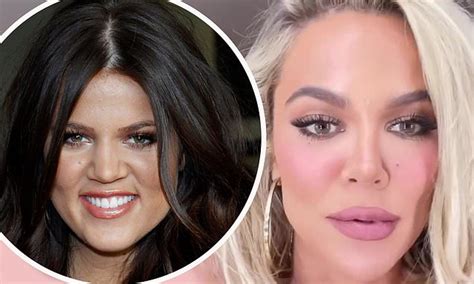Khloe Kardashian Reveals Shes Offended By Crazy Plastic Surgery