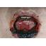Bleeding Gums  Stock Image C027/2141 Science Photo Library