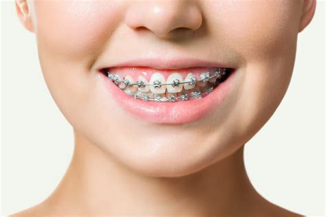 Orthodontist Reagin Orthodontics Summerville Sc
