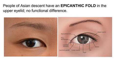 They're common in people of asian descent and a characteristic of certain medical conditions. Ch 10 The Eye | Epicanthic fold, Upper eyelid, Eyes