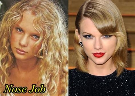 Taylor Swift Plastic Surgery Before And After Nose Job Noses