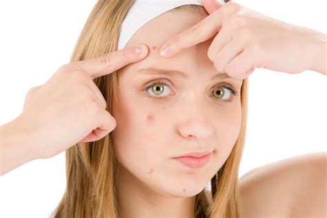 What Causes Pimples Healthcare Online
