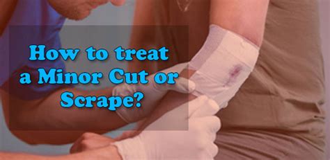 How To Treat A Minor Cut Or Scrape Dessi Nuskhe