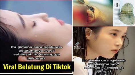 Watch Wanita Video Belatung Meninggal Viral Maggots On Tiktok Viral Di Tiktok Video Leaked