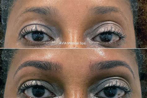 Get Natural Looking Eyebrows That Last With Microshading